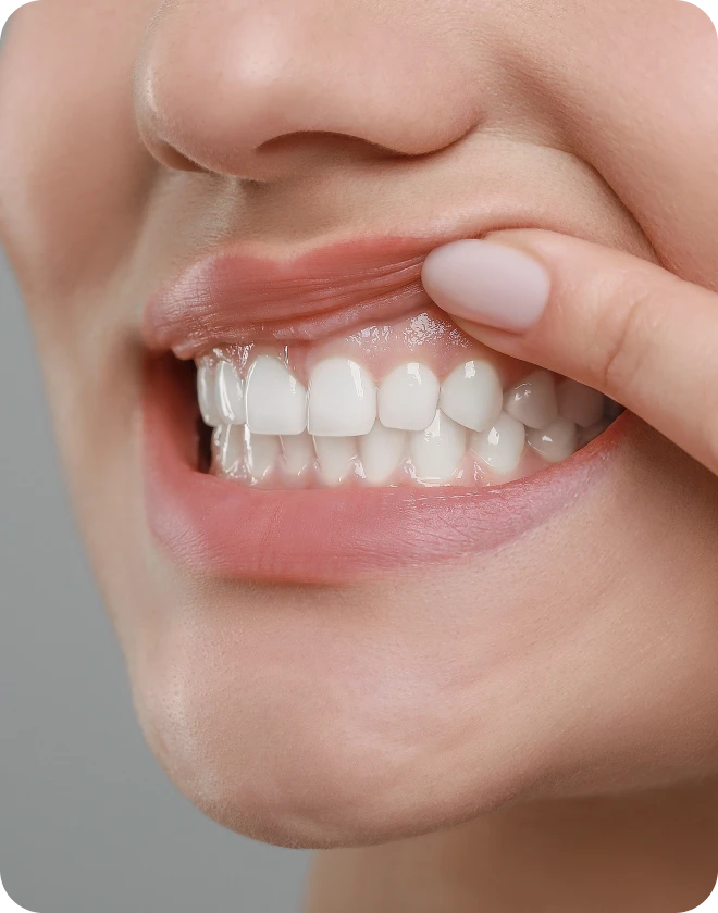 Comment garder des gencives saines ?